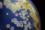 GettyImages-1086892494-bacterial-colony-dish-microscopic