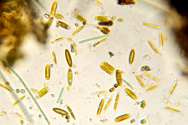 Diatoms micrograph GettyImages-116938721 Diatoms micrograph GettyImages-116938721