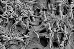 1-SEM of biofilm inside a shower hose