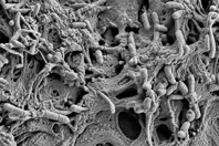 1-SEM of biofilm inside a shower hose