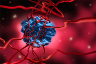 AACR 2025 Interview Series: Sizun Jiang cancer cell-tumor-GettyImages-1168181061
