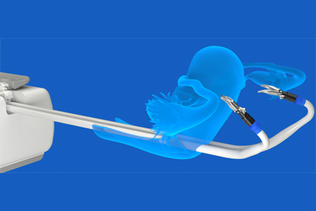 4 Key Strategies When Designing Surgical Robotics - Vimarsana News