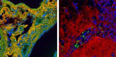 14MML015_mouse_liver_brain_LR 14MML015_mouse_liver_brain_LR