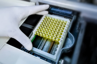 assay plate, immunology, serology-GettyImages-1425761734