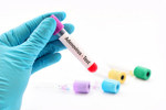 GettyImages-843764526-blood-sample-tube-aav-testing