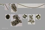 FlowCAM Detects Algal Cells, Cyanobacteria_4W_72ppi.jpg