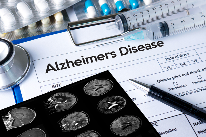 Early Onset Alzheimer's Trial - Vimarsana News