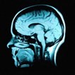 parkinsons_225x225