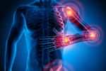 How RF Innovations Are Changing The Face Of Pain Treatment joint pain-GettyImages-1156927812