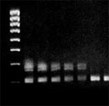 Using Gradient PCR to Determine the Optimum Annealing Temperature Using Gradient PCR to Determine the Optimum Annealing Temperature