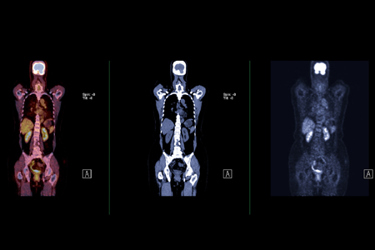 PET scan_GettyImages-1929994193 PET scan_GettyImages-1929994193