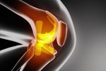 FDA Clears First RF Ablation Treatment For Osteoarthritis Knee Pain knee-anatomy_154293453-thinkstock_450x300