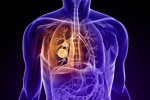 Lung--Cancer-GettyImages-103990748