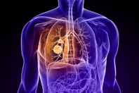 Lung--Cancer-GettyImages-103990748
