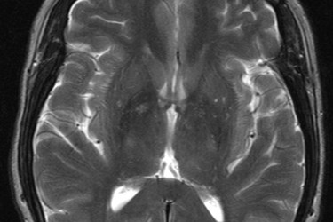 MRI_T2_Brain_axial_image. MRI_T2_Brain_axial_image.