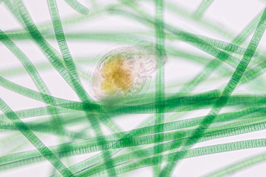 Oscillatoria-filamentous cyanobacterium-GettyImages-1171692538