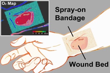 BOEx-smart bandage-image
