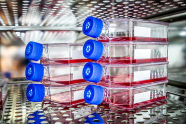 Tissue culture flask-GettyImages-519768633 Tissue culture flask-GettyImages-519768633