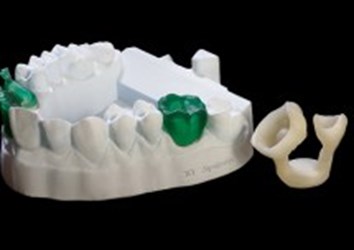 web-3d-systems-projet-3500-series-dental-model-with-projet-1200-castings web-3d-systems-projet-3500-series-dental-model-with-projet-1200-castings