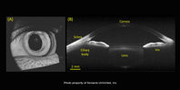 full_range_sd_oct_3d_image