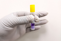 GettyImages-1187680243-biological-indicator-sterilization