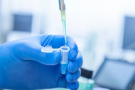 GettyImages-996054670-sample, pipette