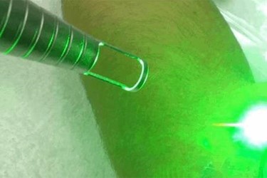 lasers lasers