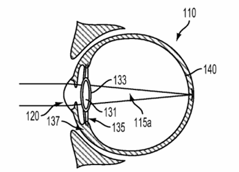 alphabet lens