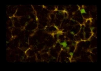 clot-imaging clot-imaging