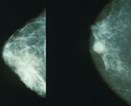 breastcancerscreening.jpg