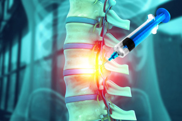 Lumbar spine injection-GettyImages-2248341900