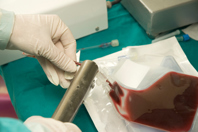 GettyImages-172799816 stem cells, blood collection