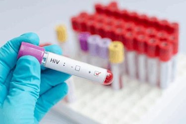 Janssen’s Encouraging HIV Vaccine Trial Results