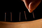 Helping Pharma Manufacturers Overcome DSCSA Interoperability Pain Points Acupuncture Needles