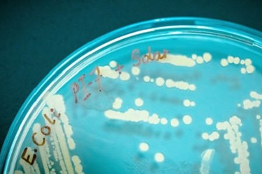 E. coli bacteriophage