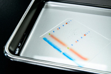 GettyImages-1323197532-western-blotting-metal-pan GettyImages-1323197532-western-blotting-metal-pan