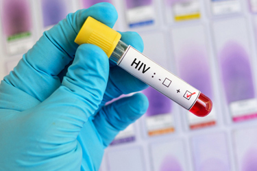 HIV possitive blood sample-GettyImages-903375720