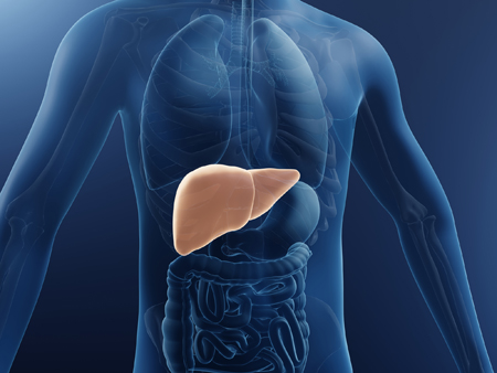 Non-Alcoholic Steatohepatitis (NASH)