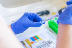 Measuring AAV Vector Genome Titer Using Droplet Digital PCR Protocol GettyImages-2166551611 ddPCR