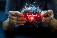 GettyImages-2180907340-woman-holding-brain-alzheimer-disease