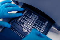 How To Evaluate And Compare Real-Time PCR Reactions GettyImages-1394835711 PCR