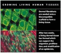 DermaGraft Stimulates New Blood Vessel Formation 