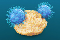 CAR T-Cell Immunotherapy-GettyImages-1321031345