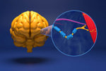 ALS, MND, Lou Gehrig's disease, terminal neurodegenerative disorder-GettyImages-2243922832