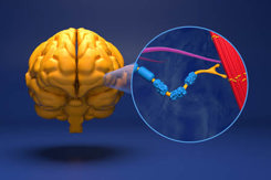 ALS, MND, Lou Gehrig's disease, terminal neurodegenerative disorder-GettyImages-2243922832