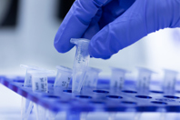 Efficient Gene Expression Profiling For Biomarker Identification GettyImages-1186871650 PCR