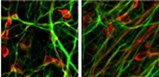 parkinsonsstem-1.jpg