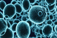 450_300-high_oxygen_demanding_microorganisms