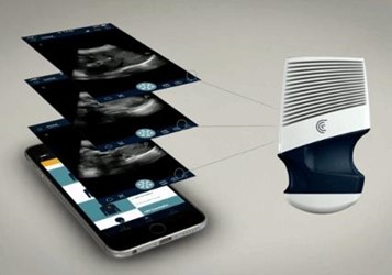 clarius wireless ultrasound