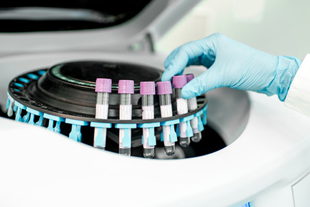 Advancing Biologics Development With Next-Generation Cell Line Development